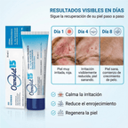 Lipogel Ozonovet 15 – Solución natural y efectiva para la piel de tu mascota